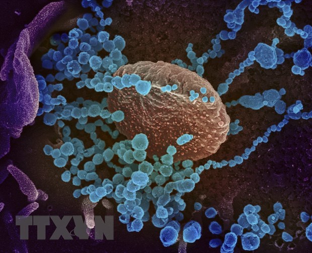 Hình ảnh quét qua kính hiển vi điện tử cho thấy virus SARS-CoV-2 (vật thể tròn màu xanh) nổi lên trên bề mặt tế bào bệnh nhân nhiễm COVID-19. Nguồn: AFP/TTXVN