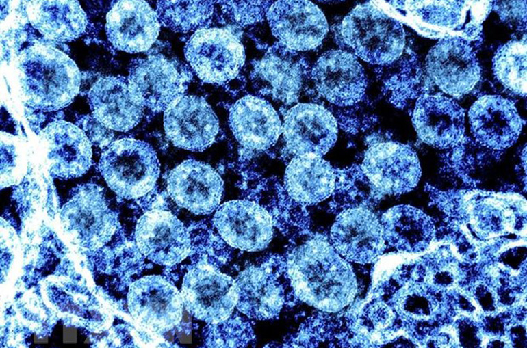 (Hình ảnh do Viện Y tế Quốc gia Mỹ (NIH) cung cấp) Virus SARS-CoV-2 chụp qua kính hiển vi điện tử trên mẫu bệnh phẩm tại phòng thí nghiệm ngày 1/8. Ảnh: AFP/TTXVN