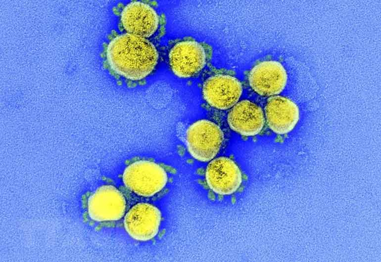 Hình ảnh từ kính hiển vi cho thấy virus SARS-CoV-2 trong mẫu bệnh phẩm của bệnh nhân. Ảnh: AFP/TTXVN