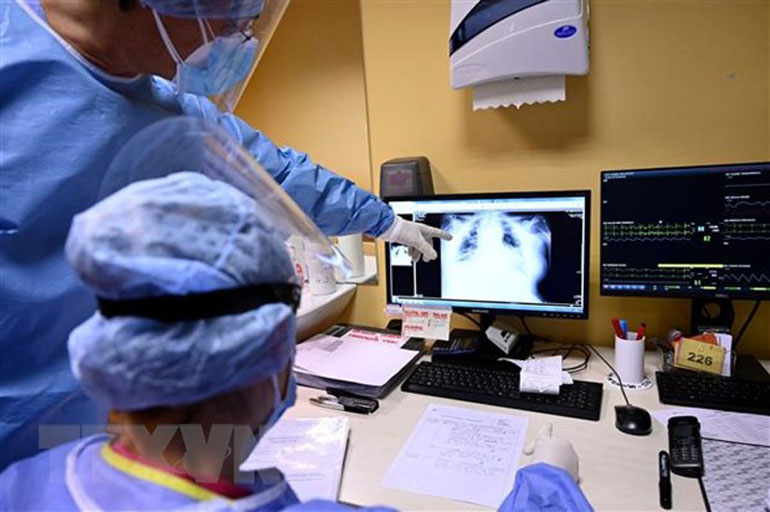 Nhân viên y tế theo dõi hình chụp X-quang phổi của một bệnh nhân COVID-19 tại bệnh viện ở Rome, Ý. Ảnh: AFP/TTXVN